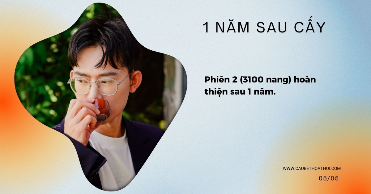 KẾT QUẢ 1 NĂM SAU CẤY TÓC CHỮA HÓI THÀNH CÔNG CỦA CẬU BÉ THOÁT HÓI