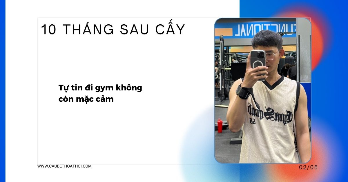 KẾT QUẢ 10 THÁNG SAU CẤY TÓC CHỮA HÓI THÀNH CÔNG CỦA CẬU BÉ THOÁT HÓI