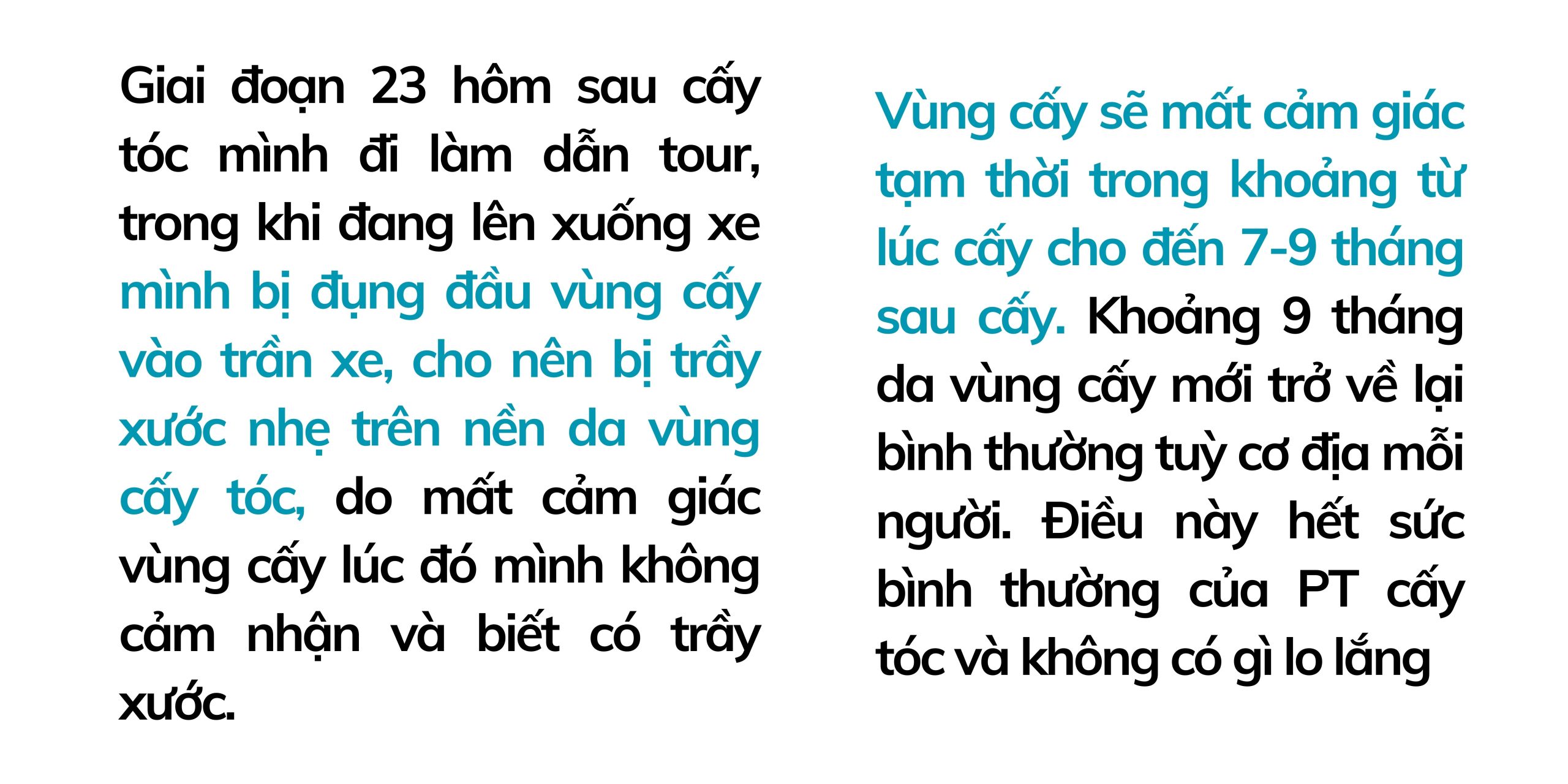 23 HÔM SAU CẤY TÓC CHỮA HÓI BẰNG CÔN NGHỆ CẤY TÓC DHI CẬU BÉ THOÁT HÓI 