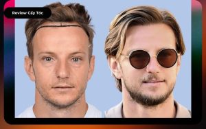 Review Cầu Thủ Ivan Rakitic trước và sau cấy tóc tự thân