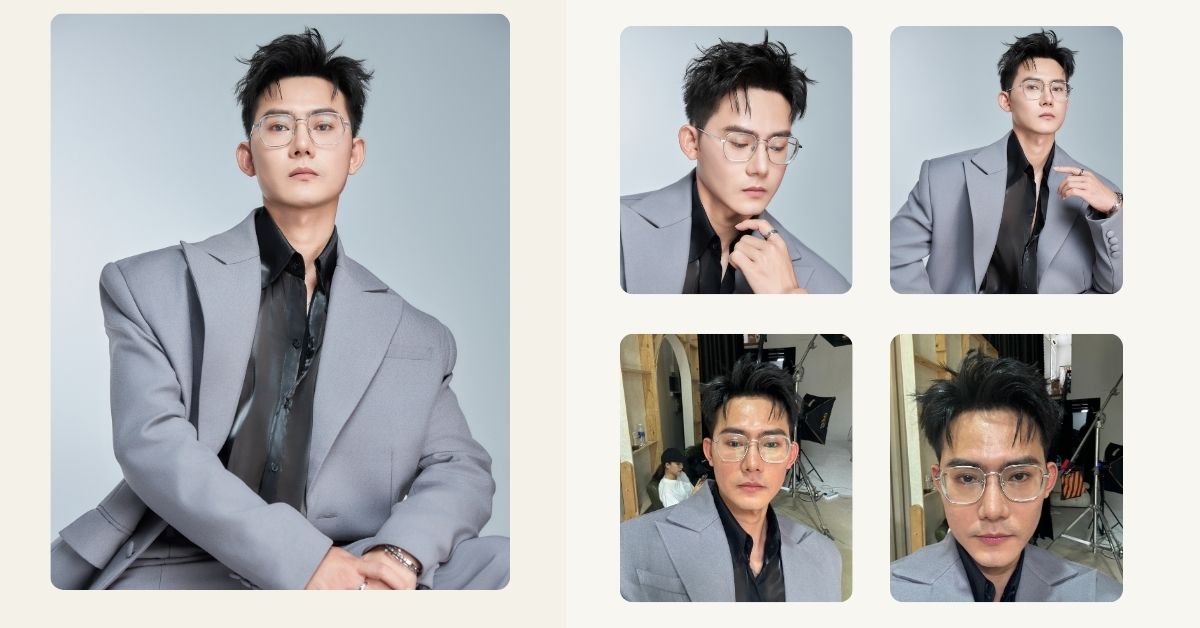 11 THÁNG SAU CẤY TÓC CHỮA HÓI THÀNH CÔNG CỦA CẬU BÉ THOÁT HÓI