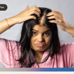 Thang Ludwig Rụng Tóc Hói Đầu Nữ