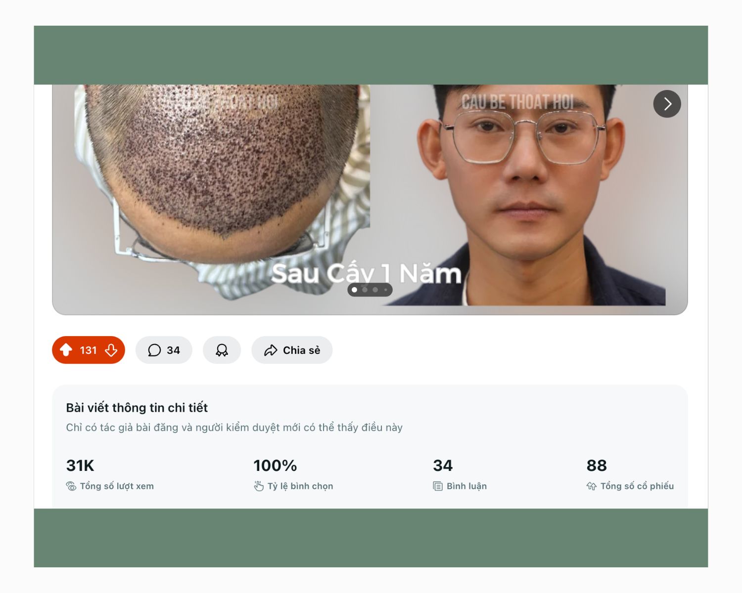BANNER CẬU BÉ THOÁT HÓI SAU KẾT QUẢ CẤY TÓC TỰ THÂN THÀNH CÔNG