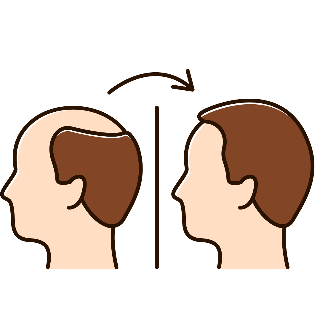 ICON CẬU BÉ THOÁT HÓI SAU CẤY TÓC TỰ THÂN