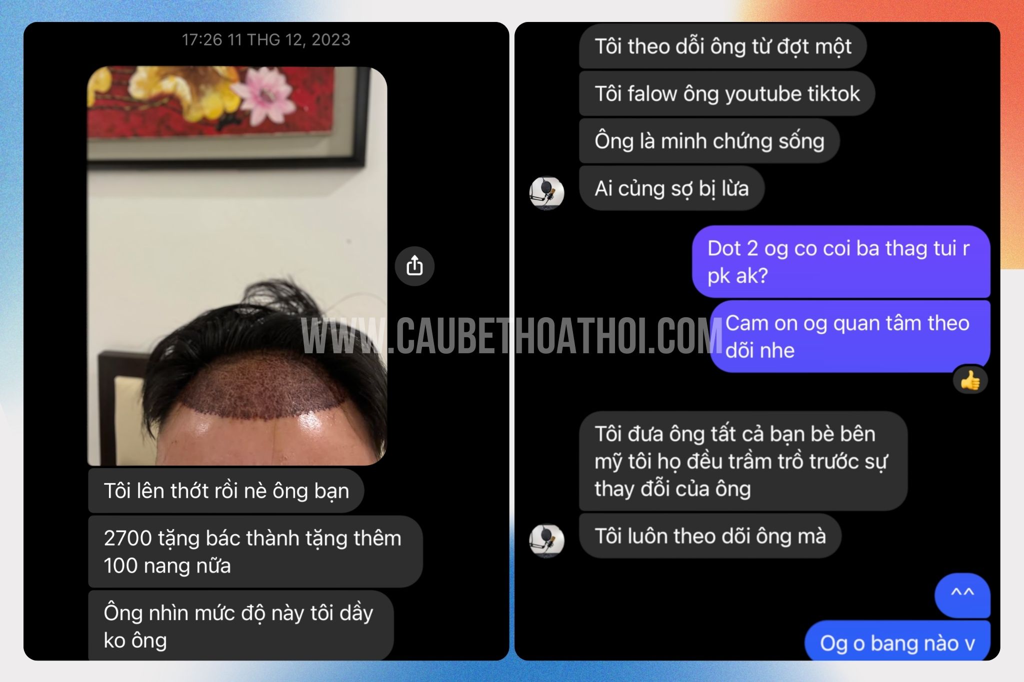 Nhật trương trước cấy tóc tự thân (2)
