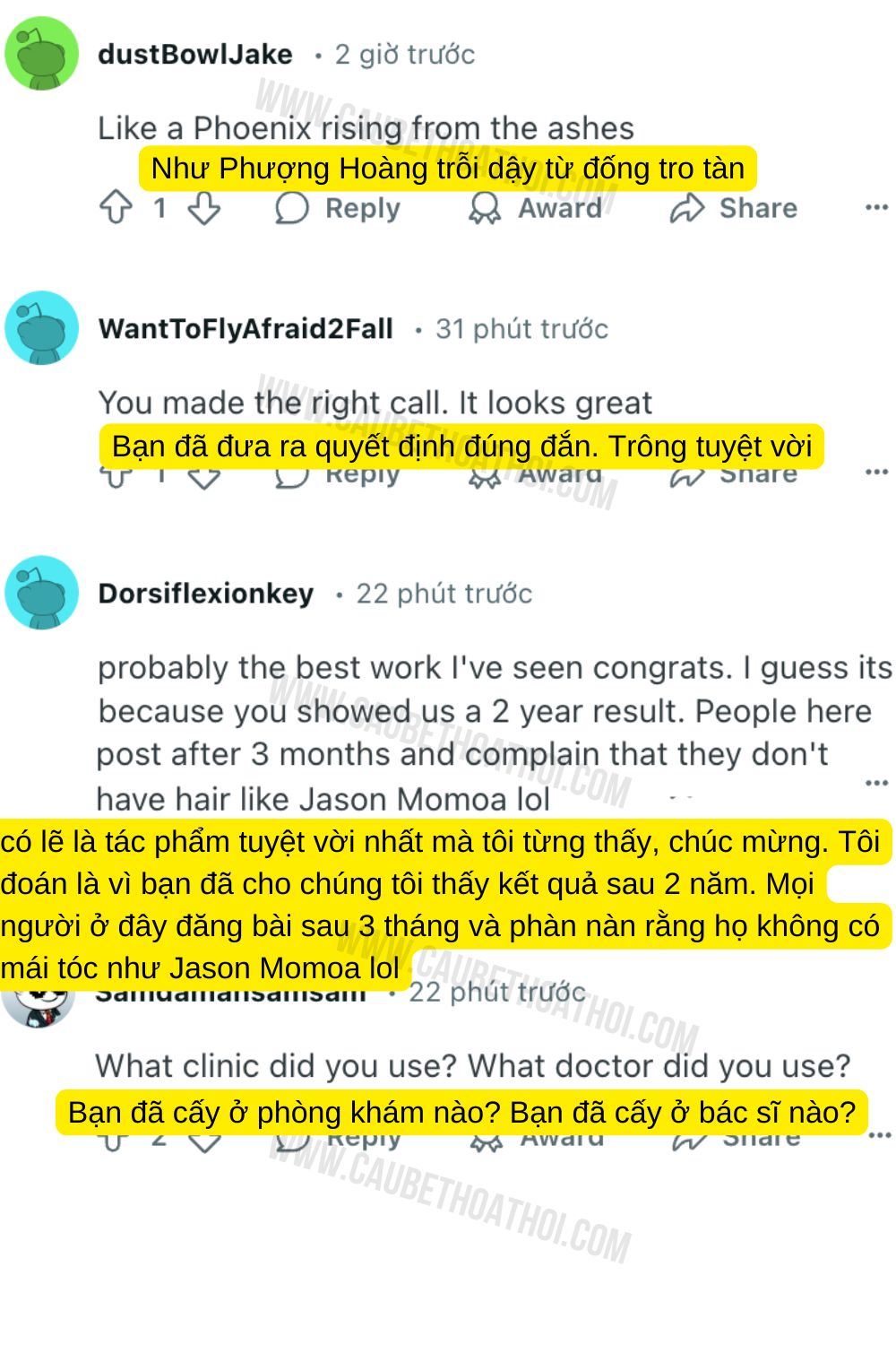 cậu bé thoát hói sau cấy tóc tự thân 2 năm