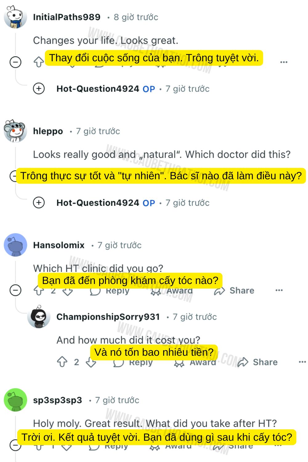 cậu bé thoát hói sau cấy tóc tự thân 2 năm
