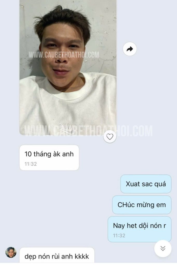 feedback trương thanh bình sau cấy tóc chữa hói thành công