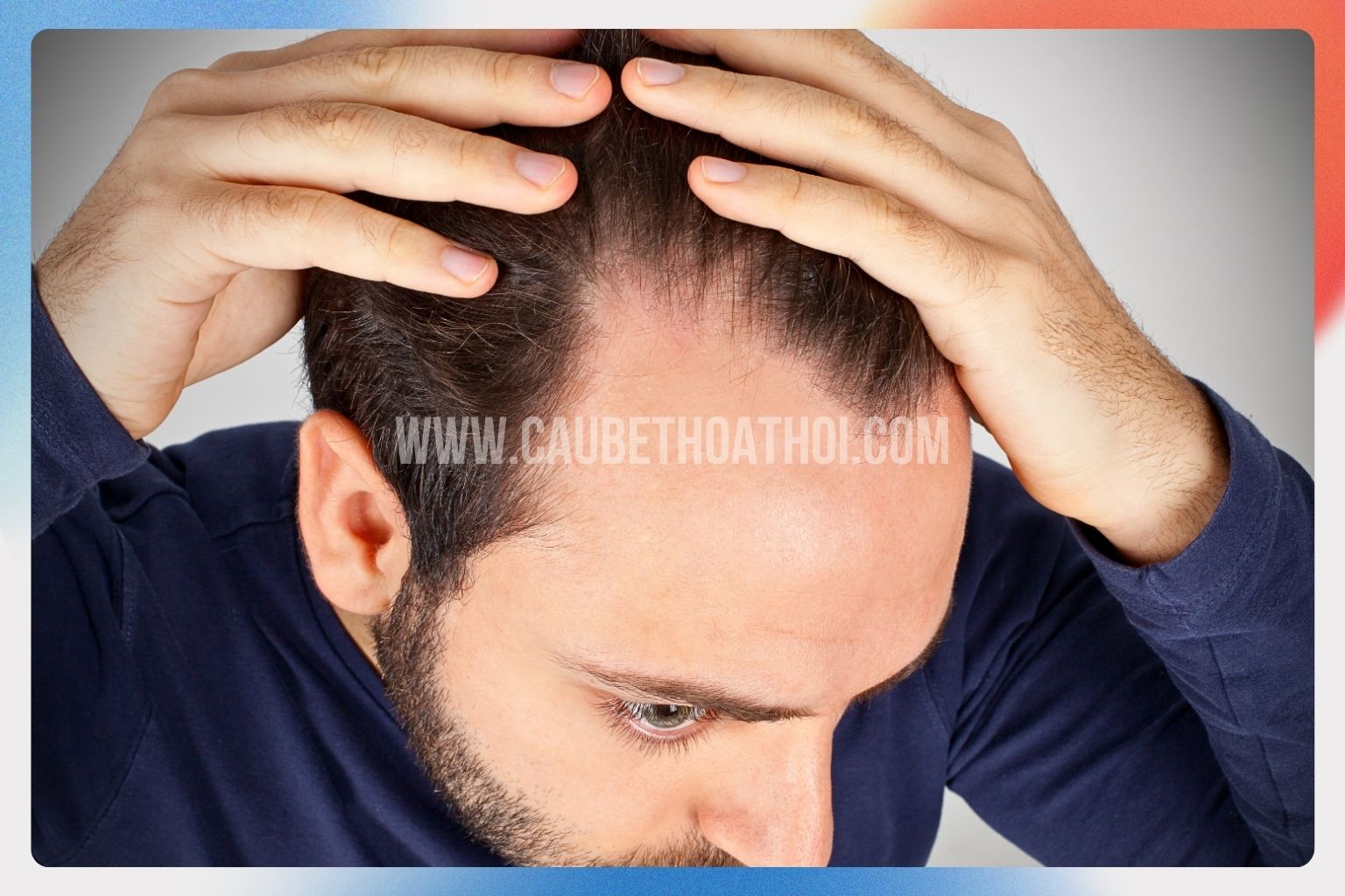 Rụng tóc do căng thẳng Căng thẳng ảnh hưởng đến tóc của chúng ta như thế nào