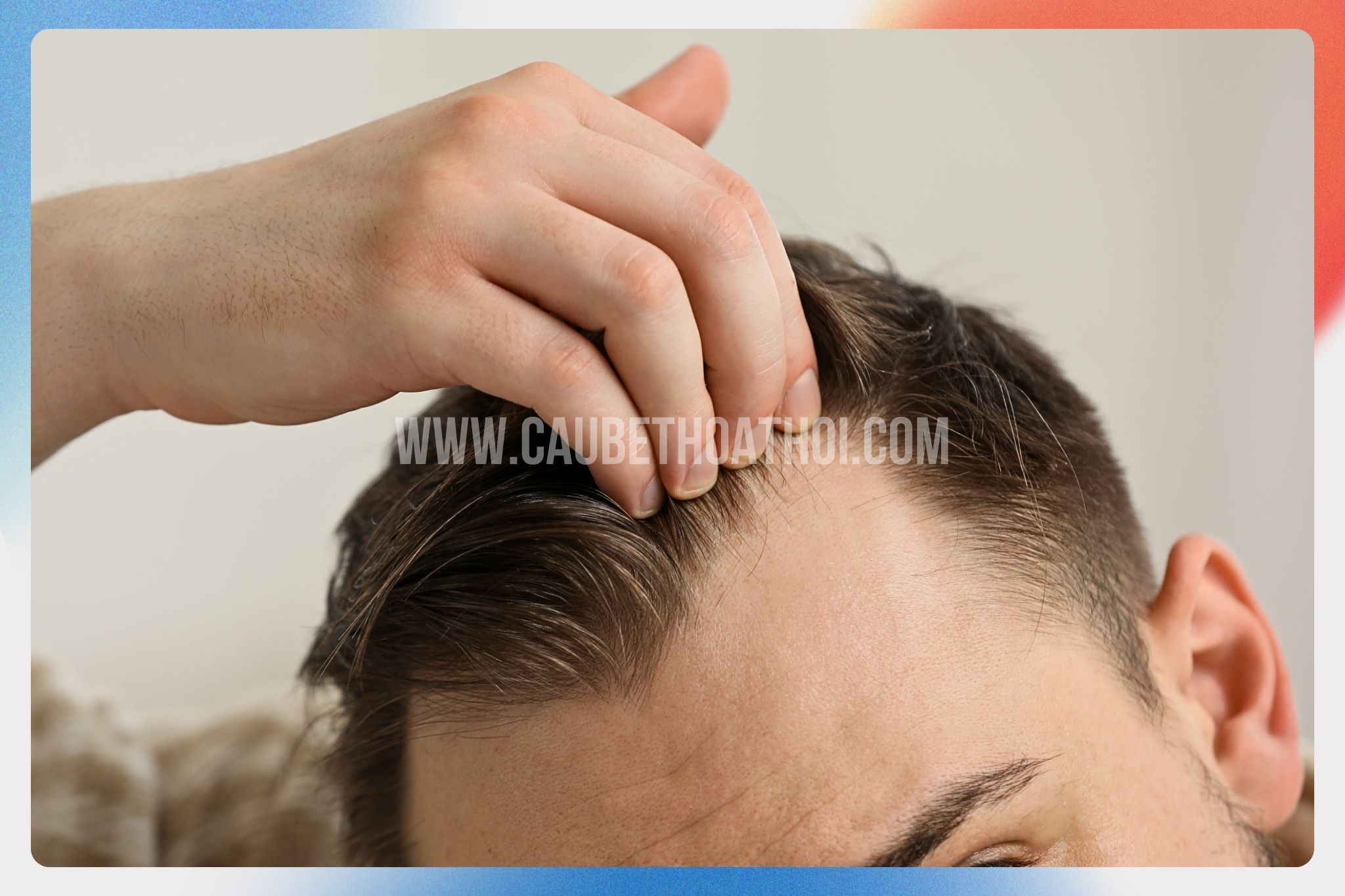 Triệu chứng của tình trạng rụng tóc telogen là gì Tóc mỏng đi trông thấy