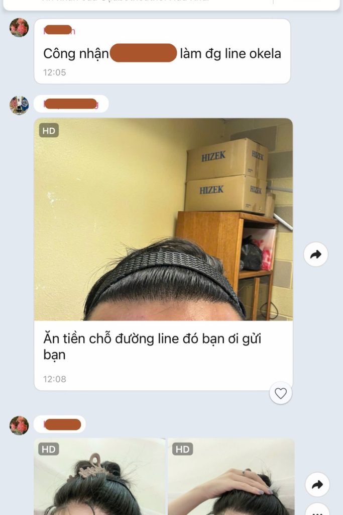 nguyễn hằng thanh sau cấy tóc nữ bò liếm thành công