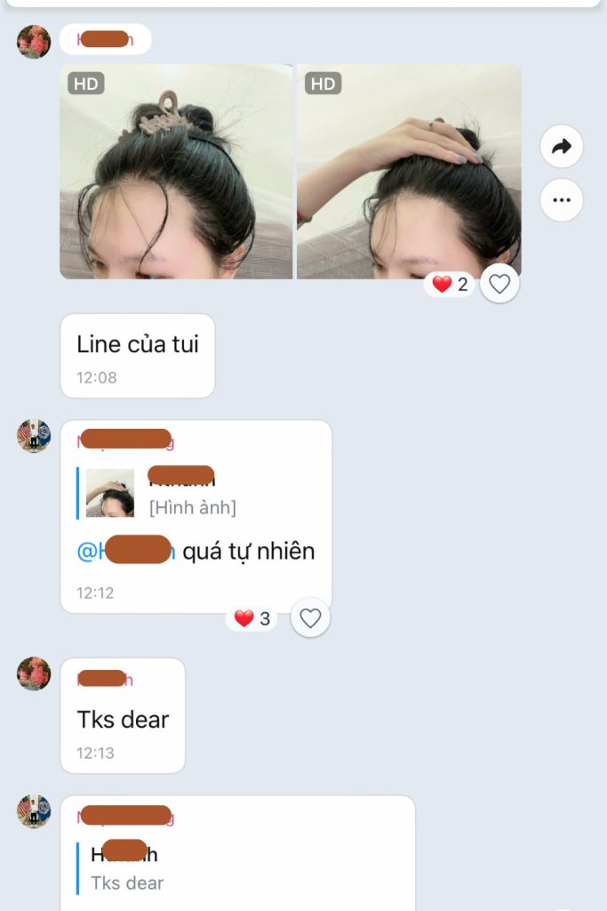 nguyễn hằng thanh sau cấy tóc nữ bò liếm thành công