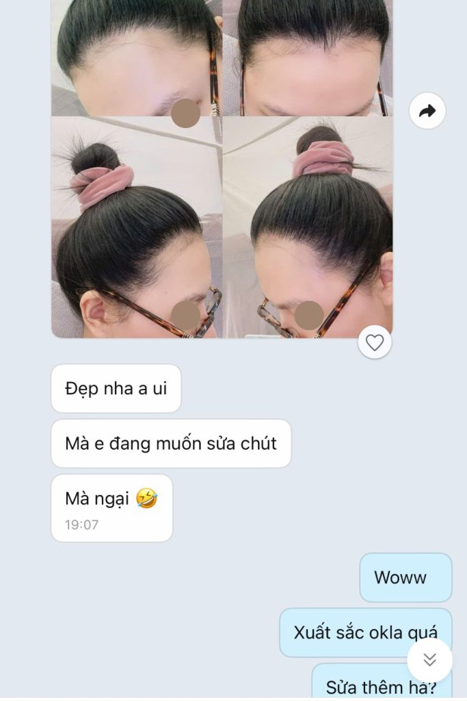 nguyễn hằng thanh sau cấy tóc nữ bò liếm thành công