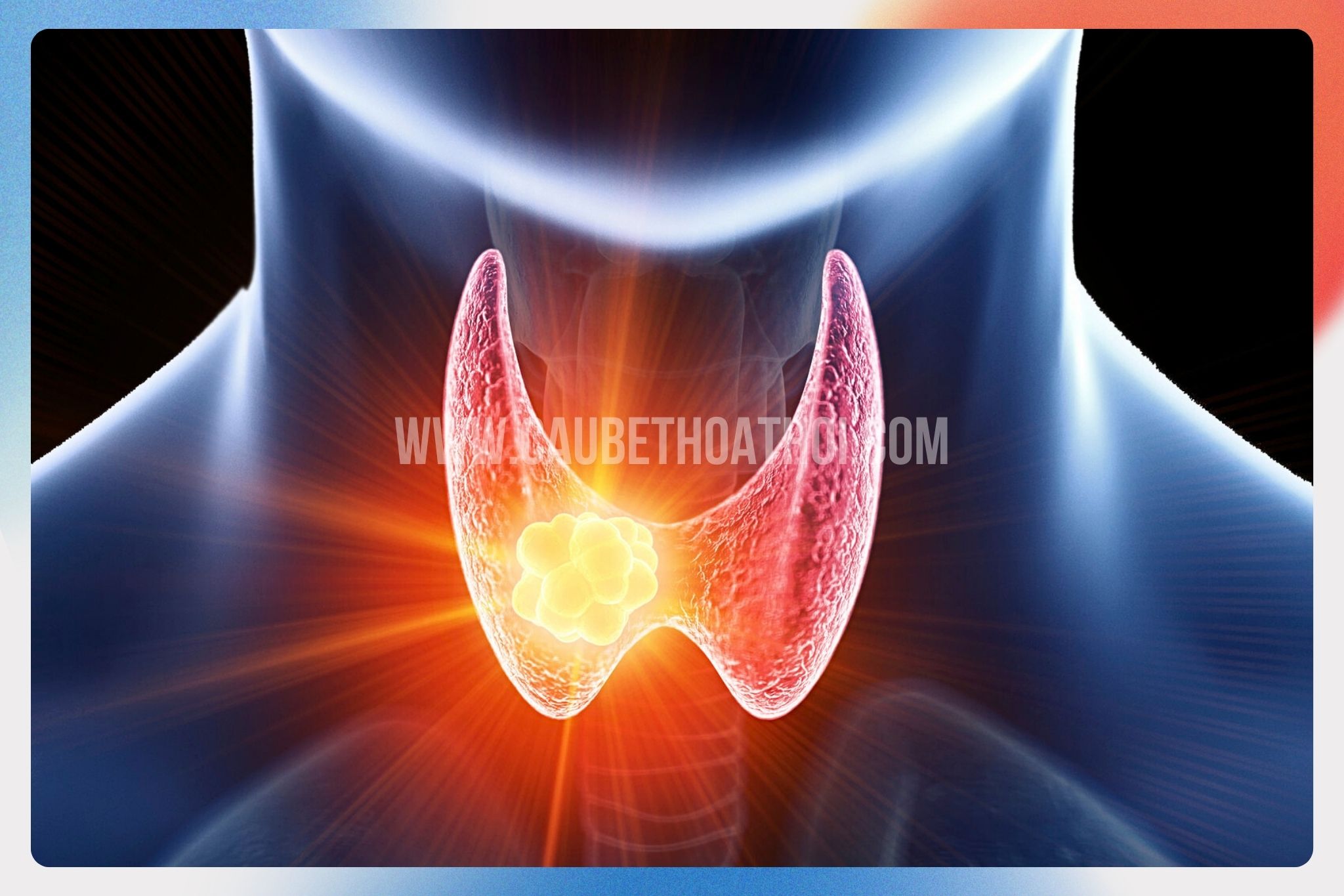 suy giáp và cường giáp cũng có thể ảnh hưởng đến chu kỳ tóc dẫn đến Rụng tóc Telogen