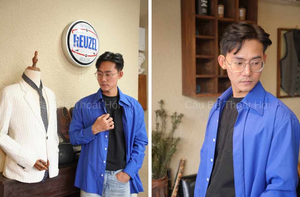 Kết Quả Cấy Tóc DHI Sau 2 Năm 1 Tháng (Tổng 5100 Nang) 1