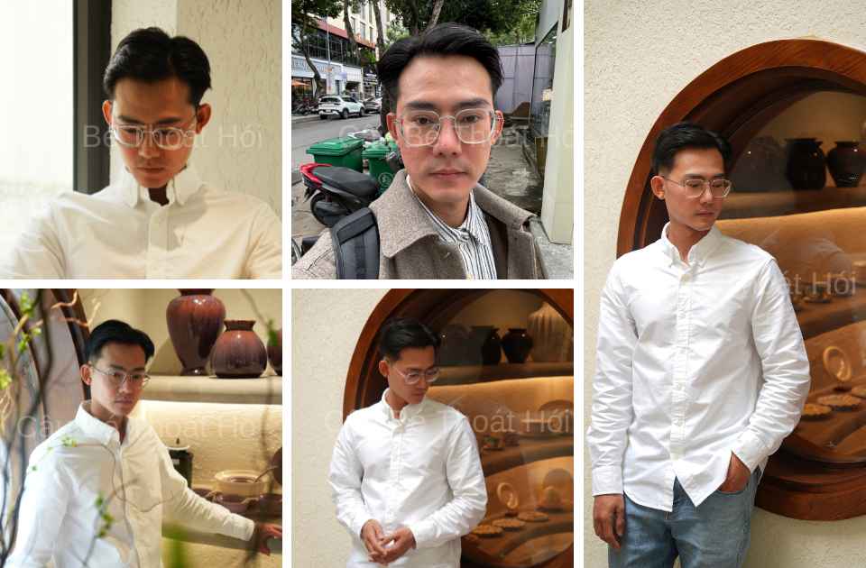 Kết Quả Cấy Tóc DHI Sau 2 Năm 2 Tháng tạo kiểu sidepart