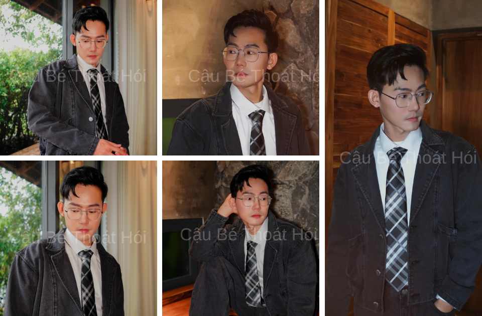 Kết Quả Cấy Tóc DHI Sau 2 Năm 2 Tháng