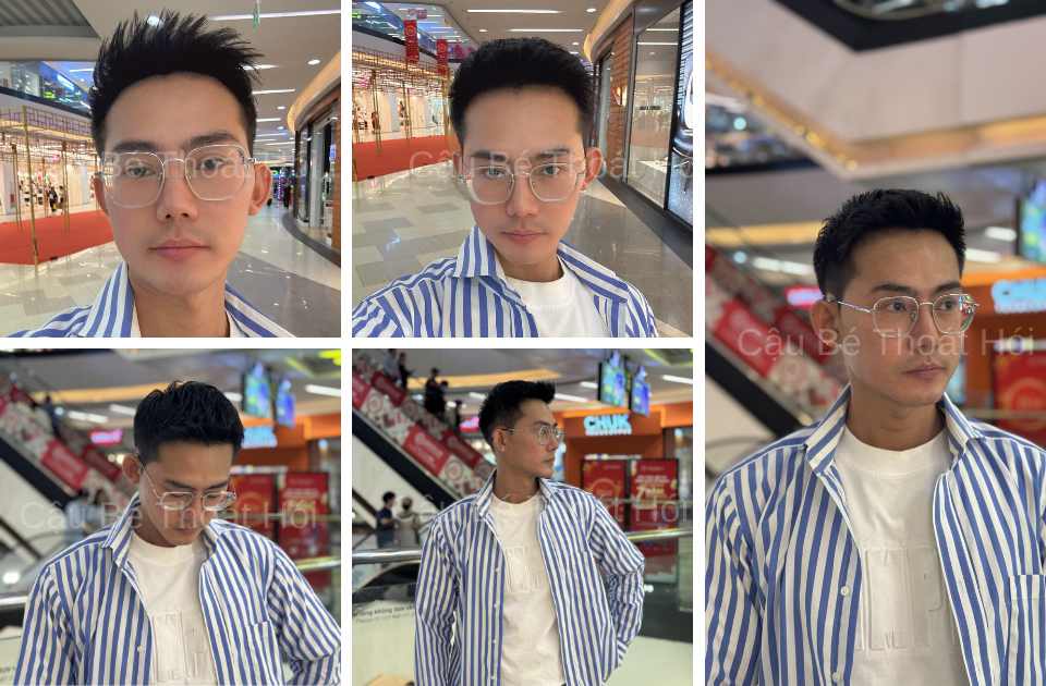 Kết Quả Cấy Tóc DHI Sau 2 Năm 4 Tháng thành công trong việc tạo kiểu ivy league