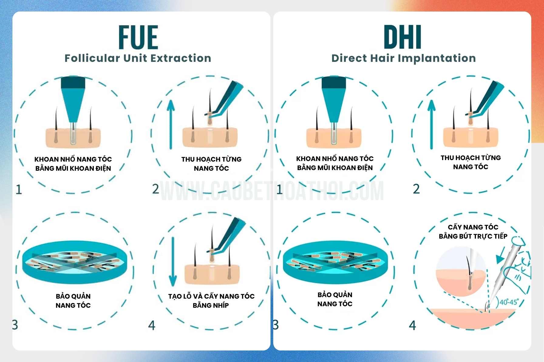Hình ảnh so sánh kỹ thuật cấy tóc DHI và FUE cho vùng đỉnh đầu